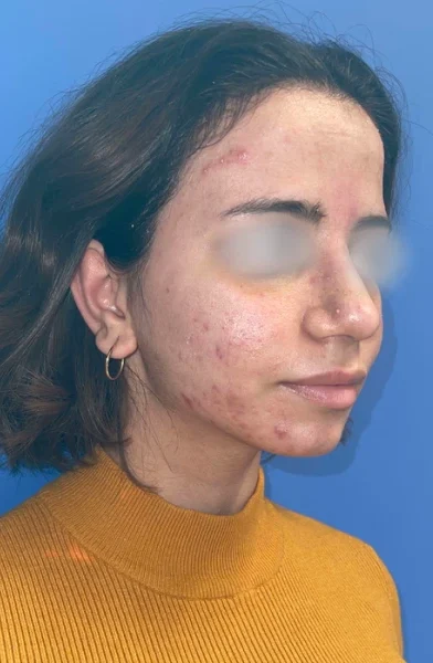 Cas 17