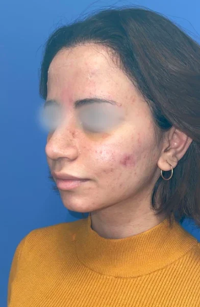 Cas 17