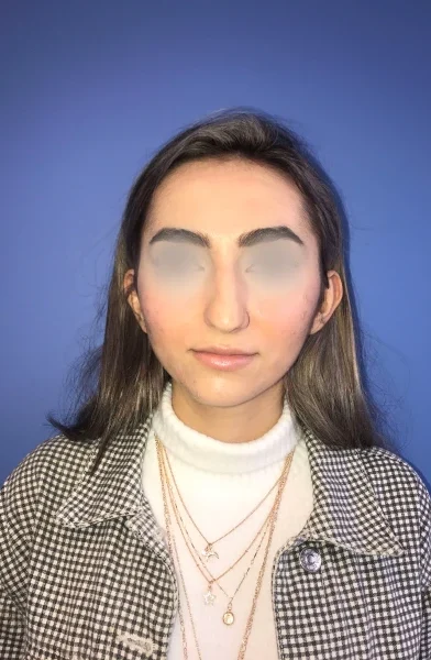 Cas 18