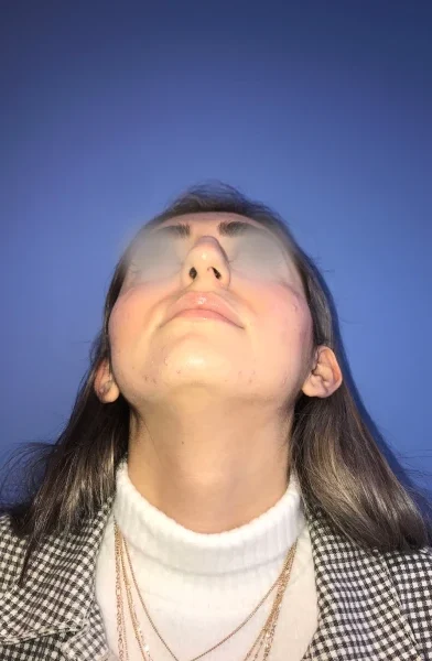 Cas 18