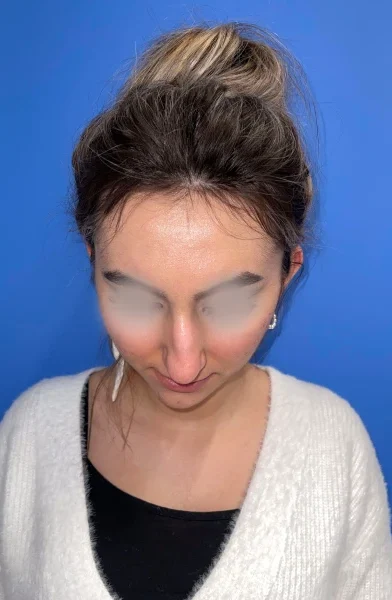 Cas 18