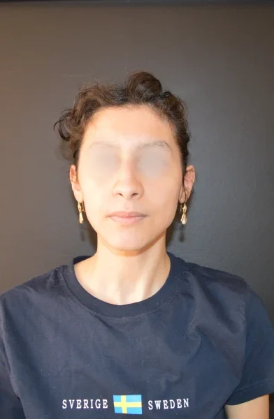 Cas 20