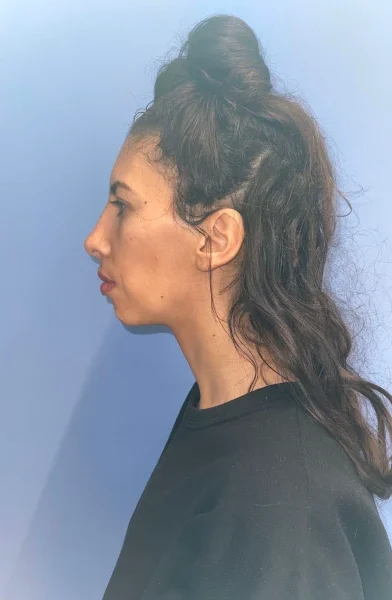 Cas 15