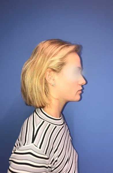 Cas 16