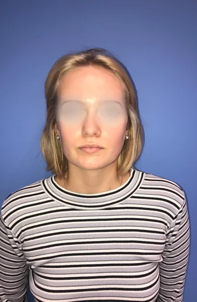 Cas 16