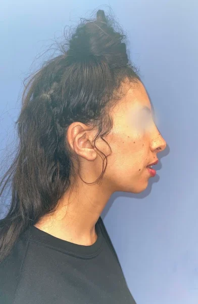 Cas 15