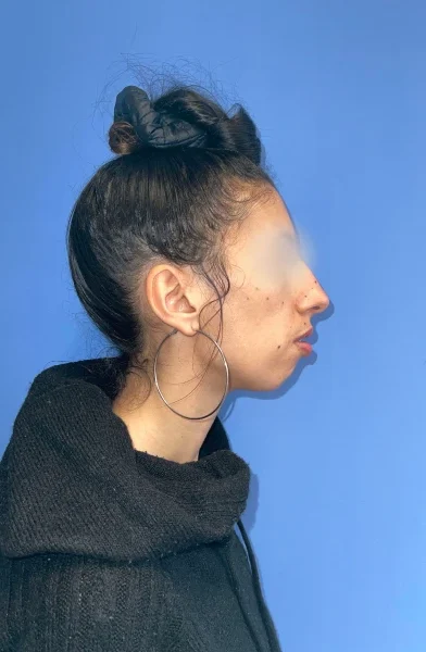 Cas 15