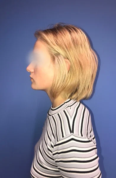 Cas 16