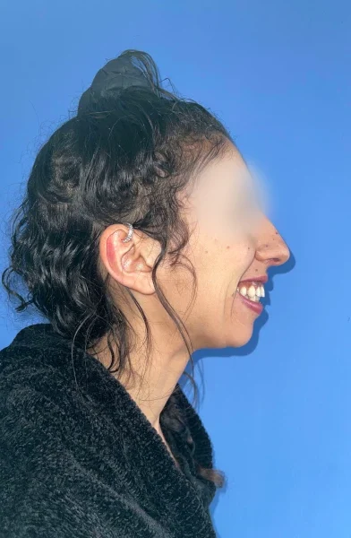 Cas 15