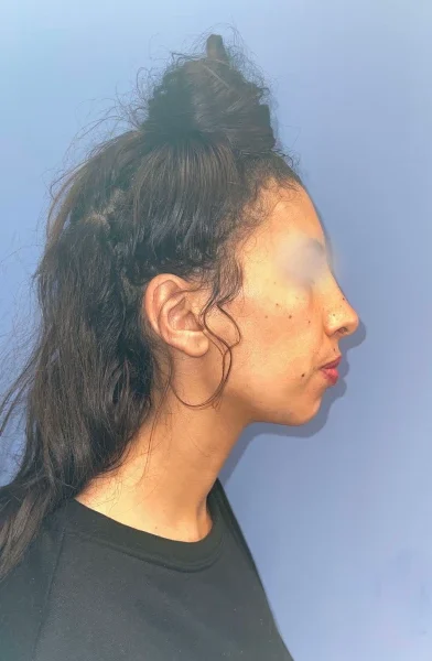 Cas 15