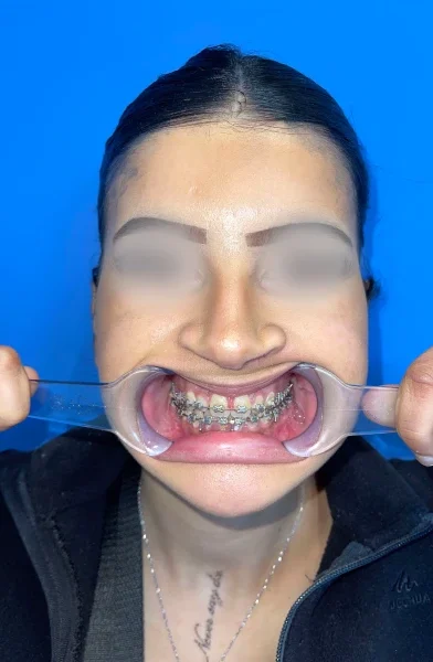 Cas 12