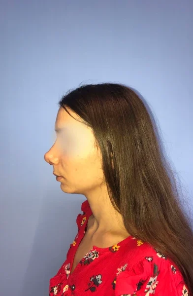 Cas 14