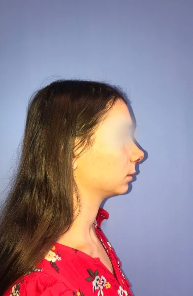 Cas 14