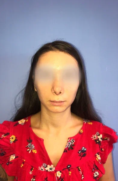 Cas 14