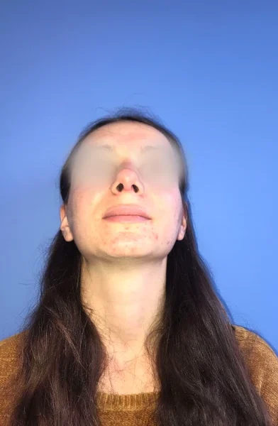 Cas 14