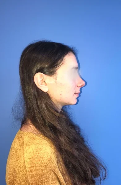 Cas 14