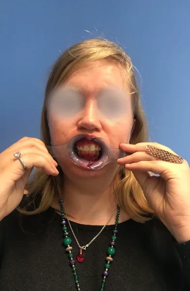 Cas 10