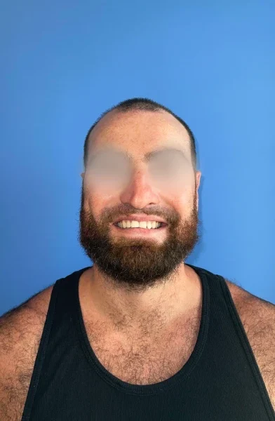 Cas 8