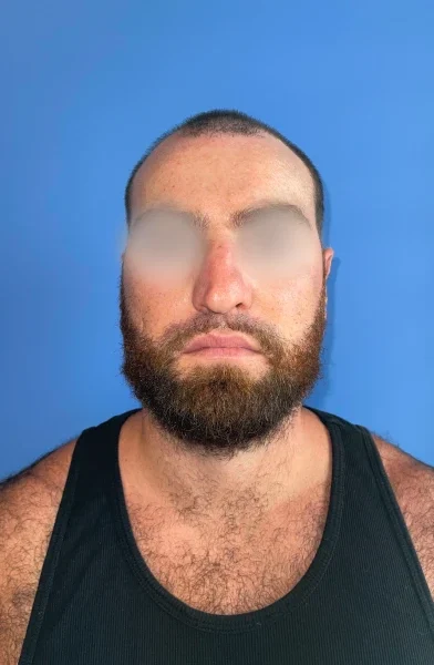 Cas 8