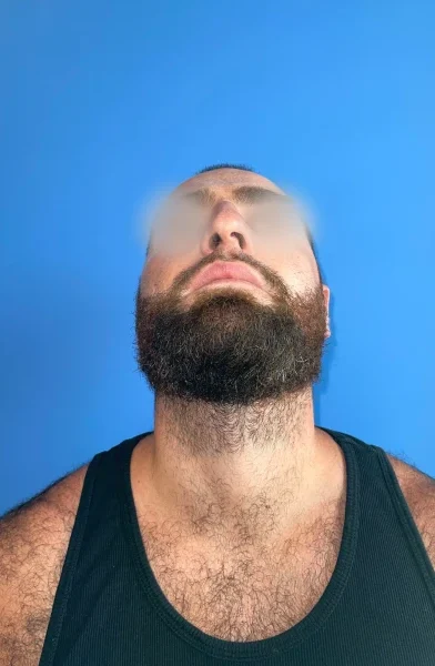 Cas 8
