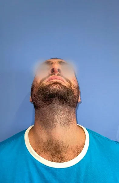 Cas 8