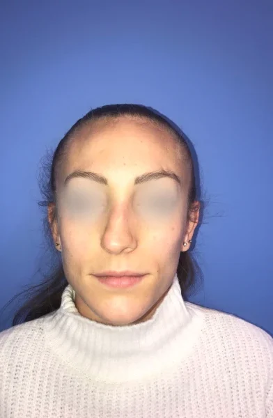 Cas 7