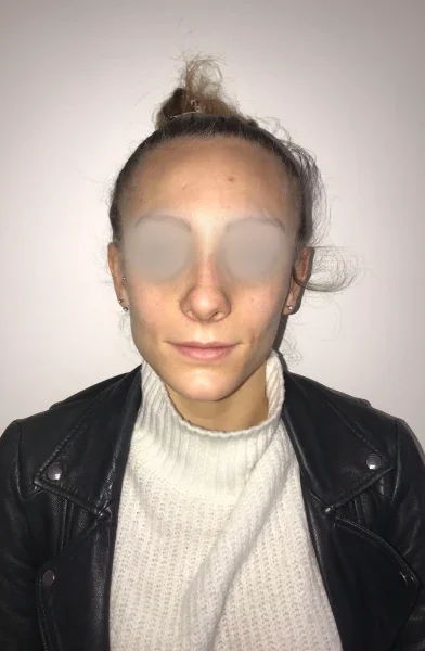 Cas 7