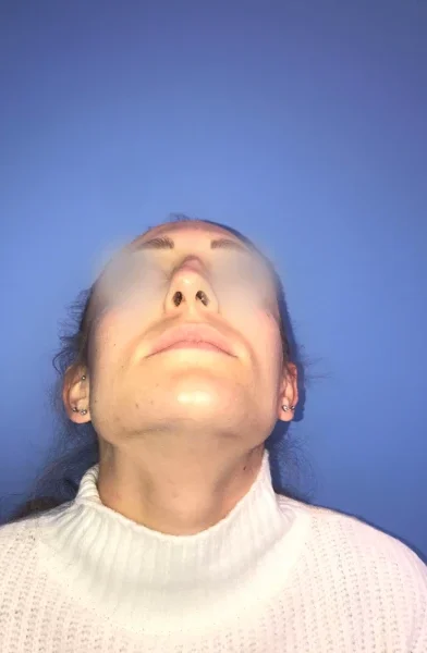 Cas 7