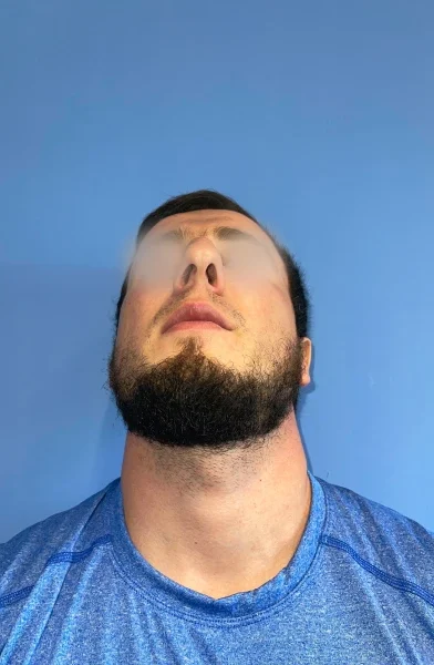Cas 6
