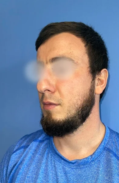 Cas 6