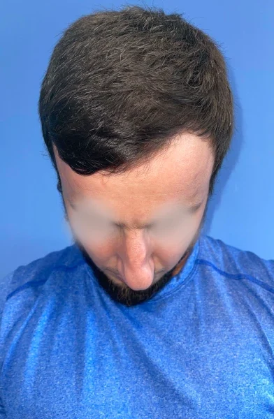 Cas 6
