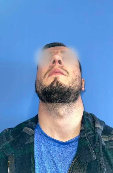 Cas 6