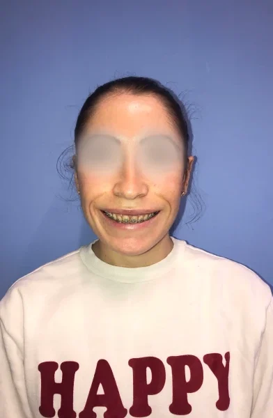 Cas 23