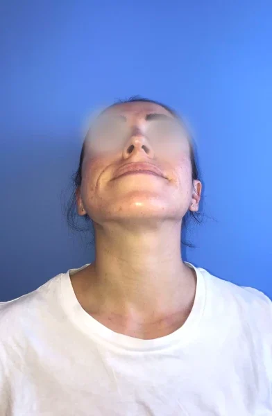 Cas 23