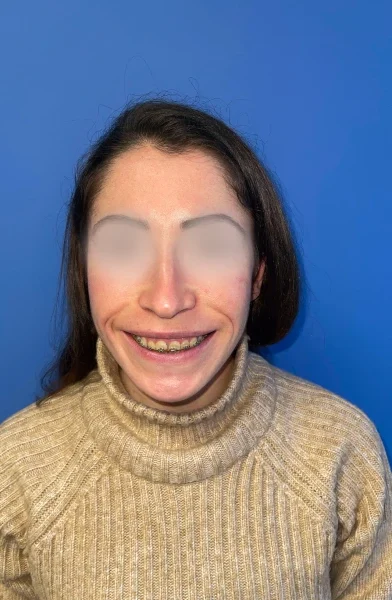 Cas 23