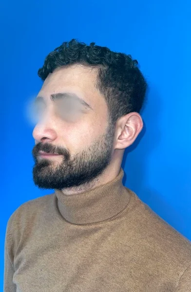Cas 5