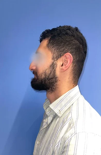 Cas 5