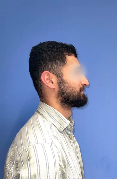 Cas 5
