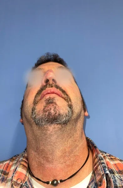 Cas 4