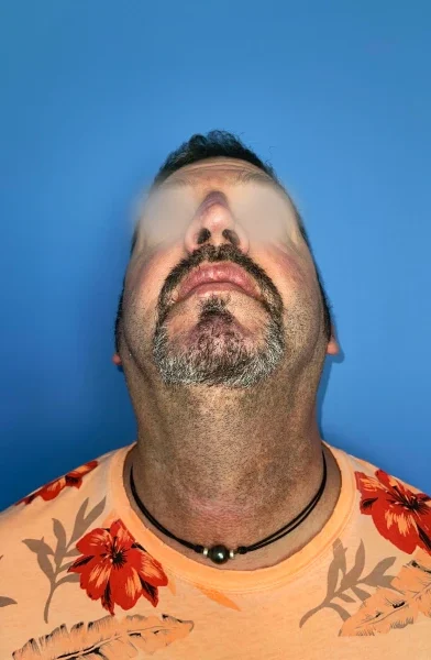 Cas 4