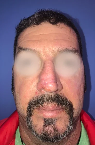Cas 4