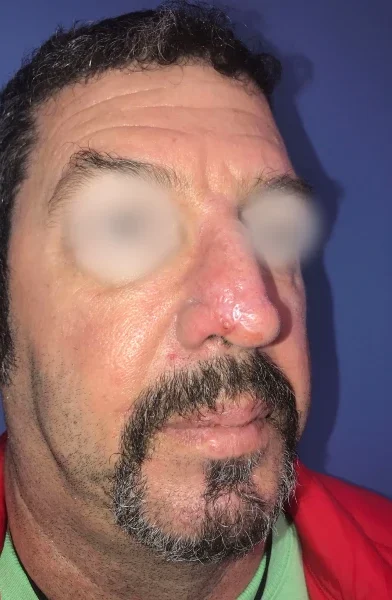 Cas 4