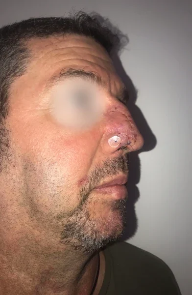 Cas 4