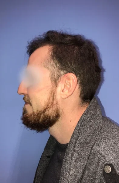 Cas 2