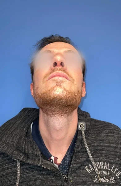 Cas 2