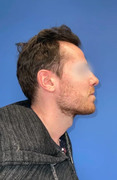 Cas 2