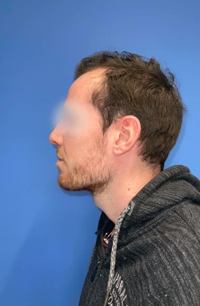 Cas 2