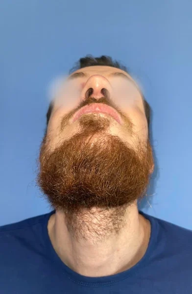 Cas 2