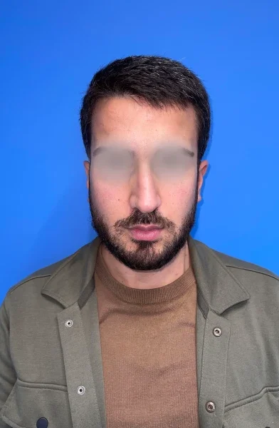 Cas 1