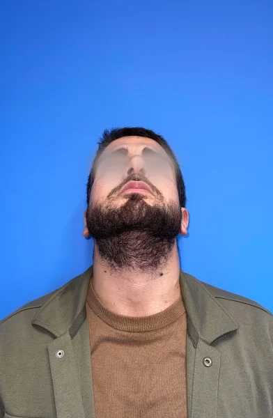 Cas 1